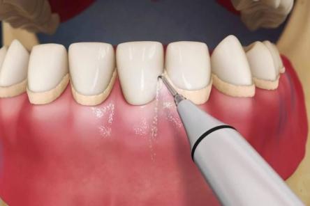 Бесплатную профгигиену полости рта будут проводить для коллег стоматологи ННГУ